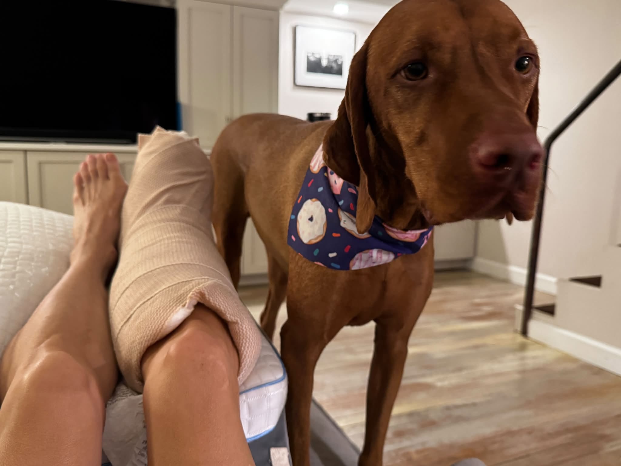 Miksa, a rust-colored Vizsla in a donut-print bandana, stands on the wood floor giving the camera a puzzled look next to my bandaged leg propped up on a wedge pillow.