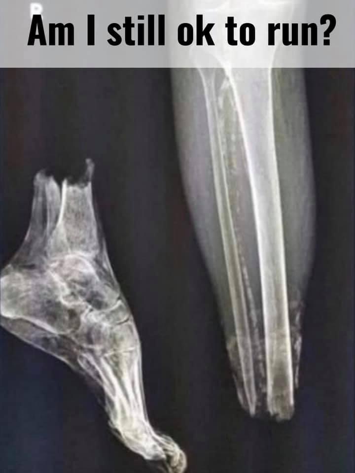 A meme x-ray captioned 'Am I still ok to run?', showing the bones of a spindly bird-like leg beside a small splayed foot, gently poking fun at whether it's wise to go running.