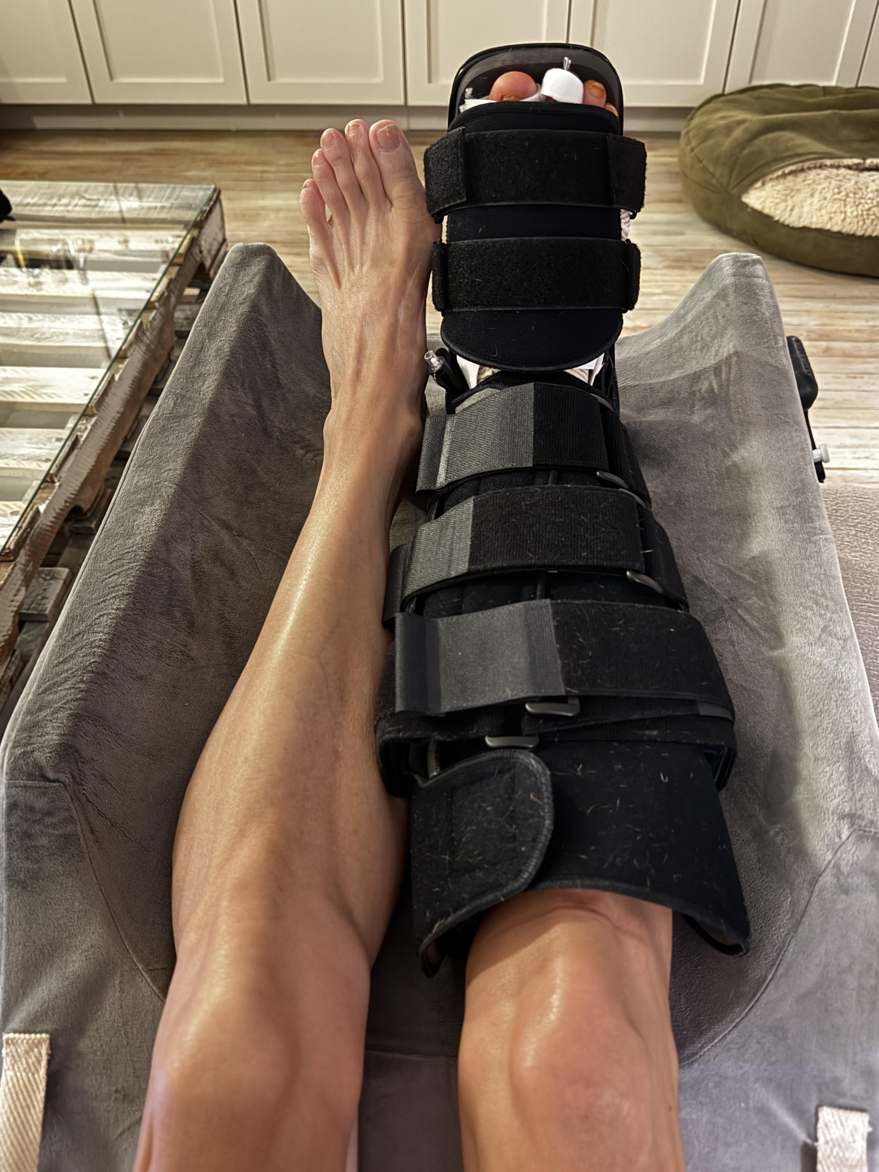 My right leg propped on a gray wedge pillow, locked into a tall black cam walker boot with rows of wide velcro straps running from shin to forefoot, my toes just barely peeking out past the end of it, with my bare left leg stretched out alongside for comparison.
