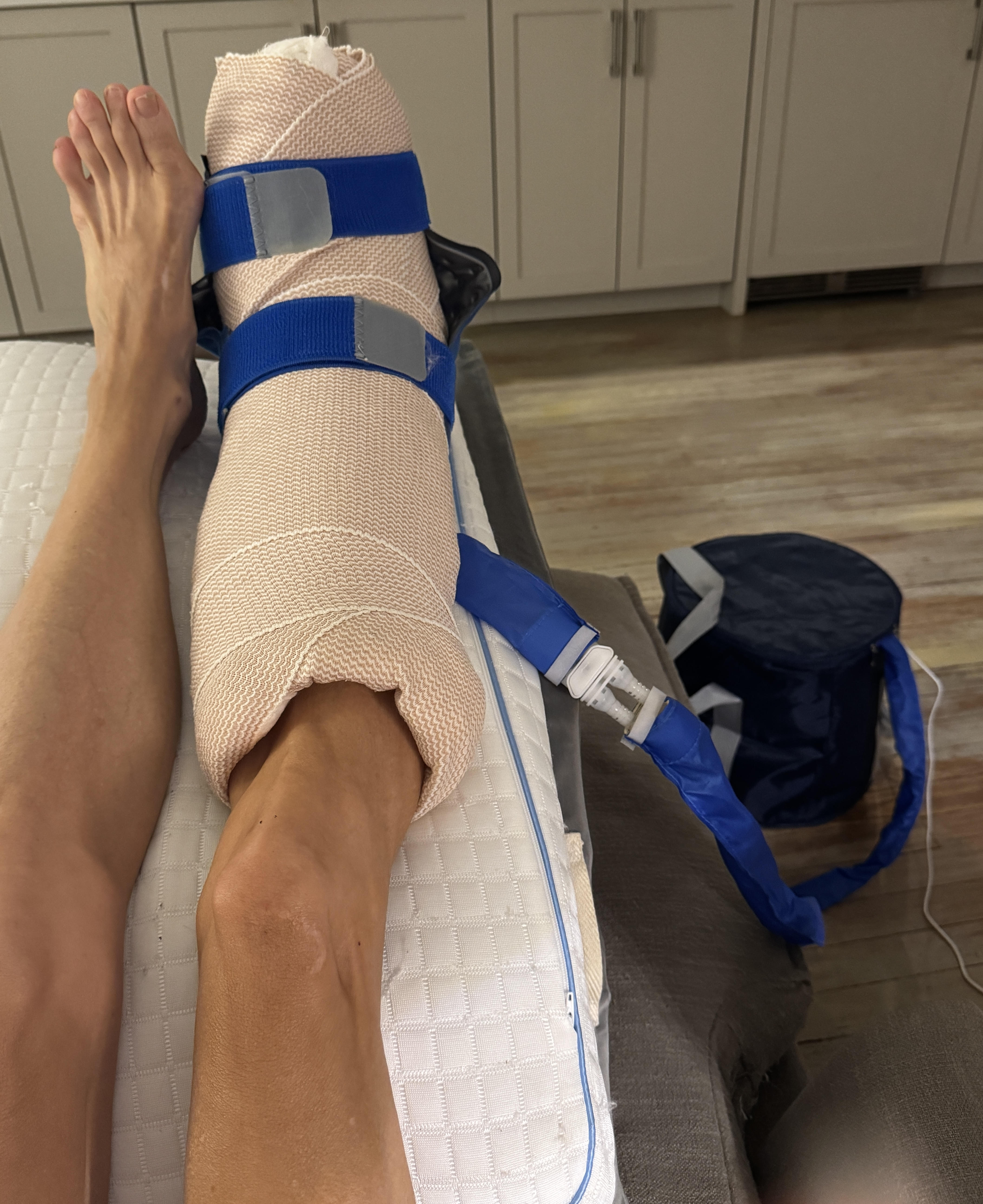 A bandaged lower leg propped on a white wedge pillow, wrapped in a beige compression dressing with blue straps holding an ice-machine cuff in place, connected by a blue insulated hose to a navy cooler on the floor.