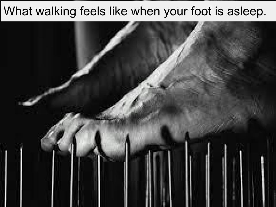 A black-and-white meme: a bare foot resting on top of a dense bed of long, upright metal nails, captioned across the top, 'What walking feels like when your foot is asleep.'